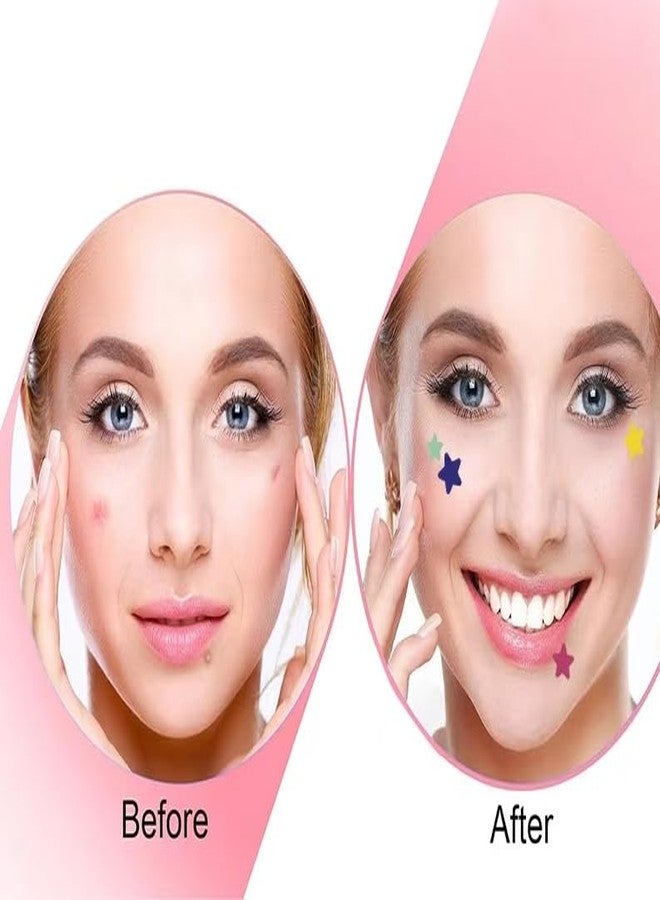 Jinshining لصقات جينشينينج الزرقاء لعلاج حب الشباب، 10 لصقات/عبوة، لصقات هيدروكولويد لعلاج حب الشباب، لصقات لطيفة على شكل نجمة لعلاج حب الشباب، ملصقات وجه لطيفة، شرائط تنظيف المسام، علاجات وأقنعة - Image 2